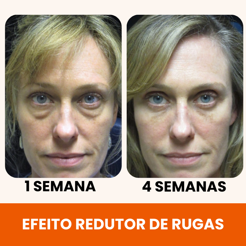 Renova 10C - 20 Anos Mais Jovem