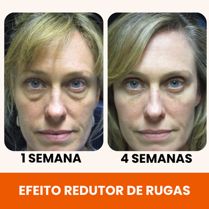 Renova 10C - 20 Anos Mais Jovem