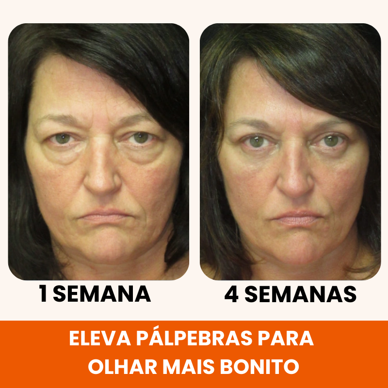 Renova 10C - 20 Anos Mais Jovem