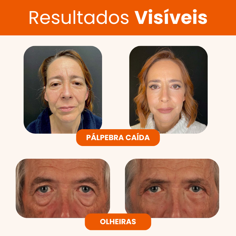 Renova 10C - 20 Anos Mais Jovem