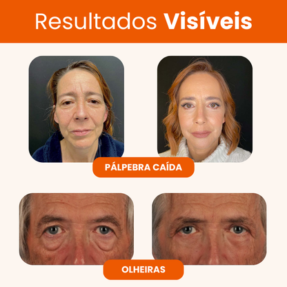 Renova 10C - 20 Anos Mais Jovem